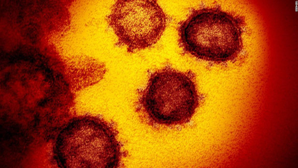Cierta inmunidad al covid-19 sin haber tenido coronavirus. ¿Por qué?
