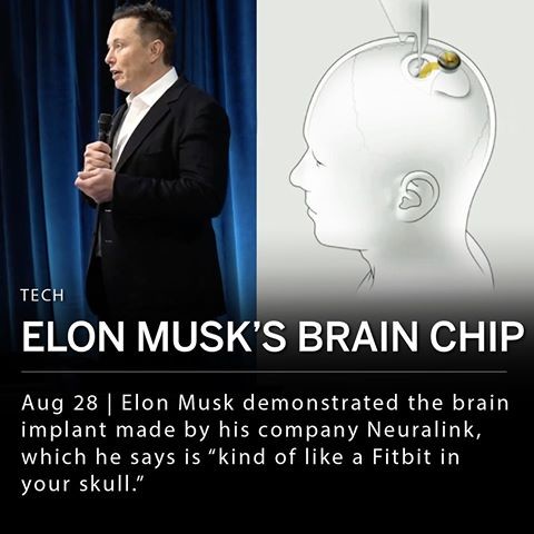 Se pondrian un chip en el cerebro🧐🤨🤔